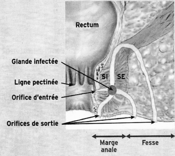 proctologie
